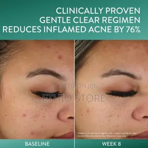 Cetaphil Gentle Clear Mattifying Acne Moisturizer