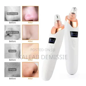 Multifunctional Blackhead Remover ፅድት ፍክት ያለ ፊት አንዲኖሮት የሚረዳ ማሽን