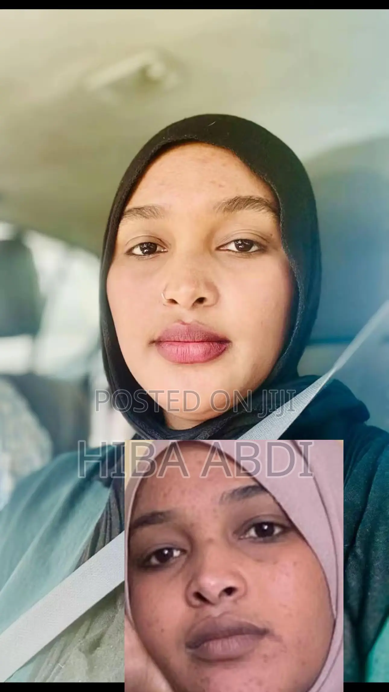 Whitening Your Face and Body