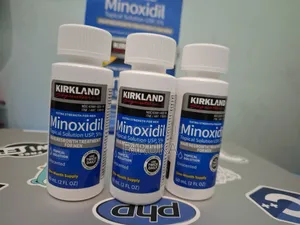 Minoxidil Hair Growth Solution