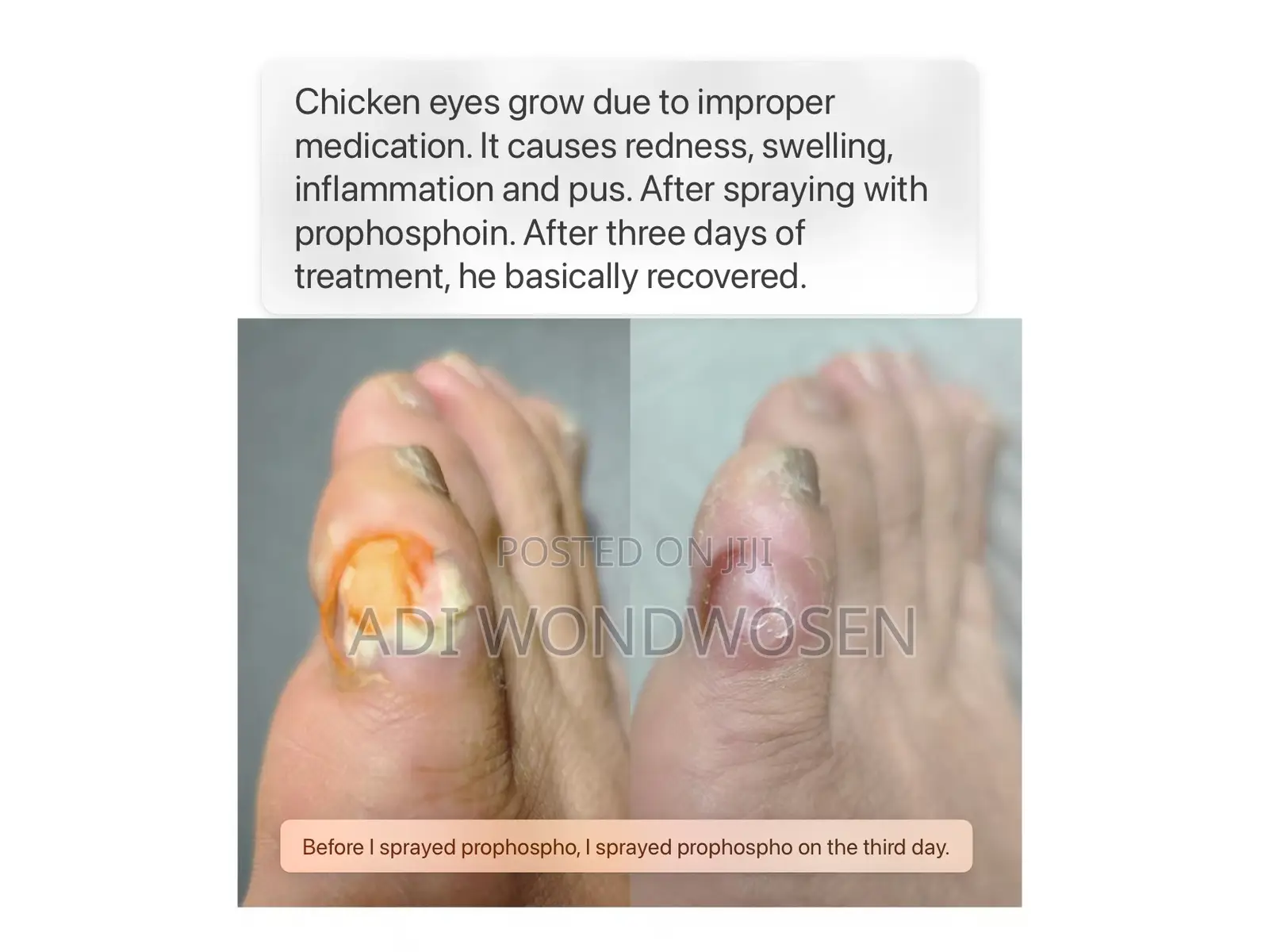 Gene Repair Liquid Spray