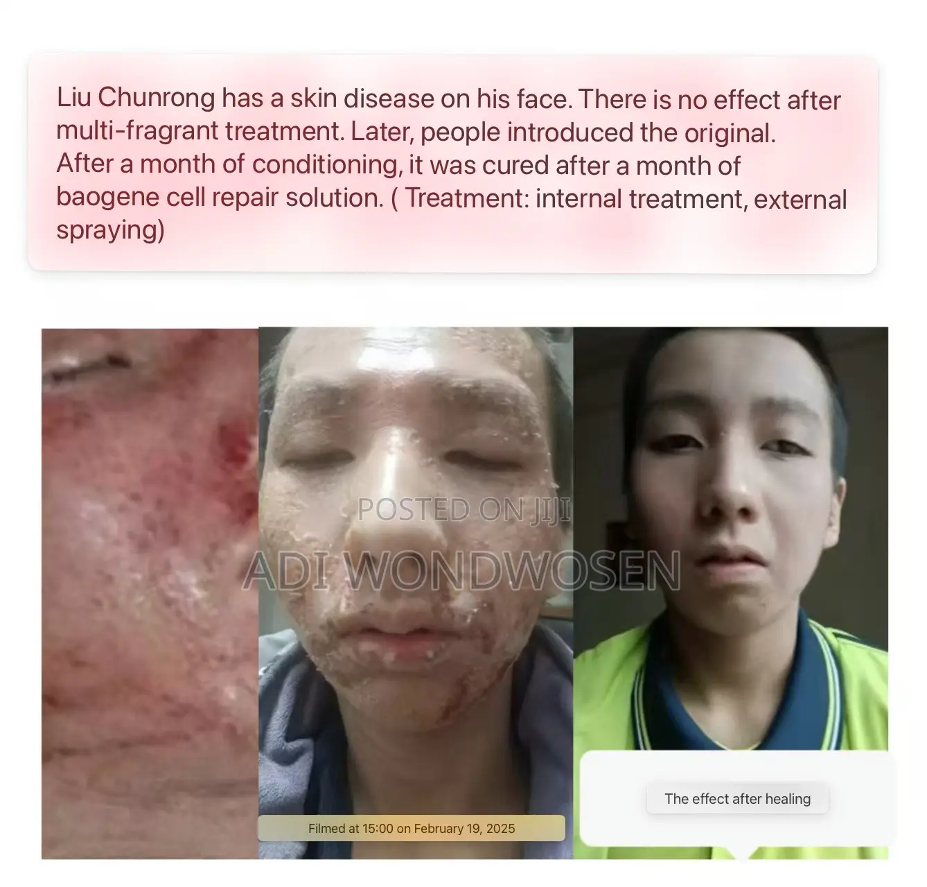 Gene Repair Liquid Spray