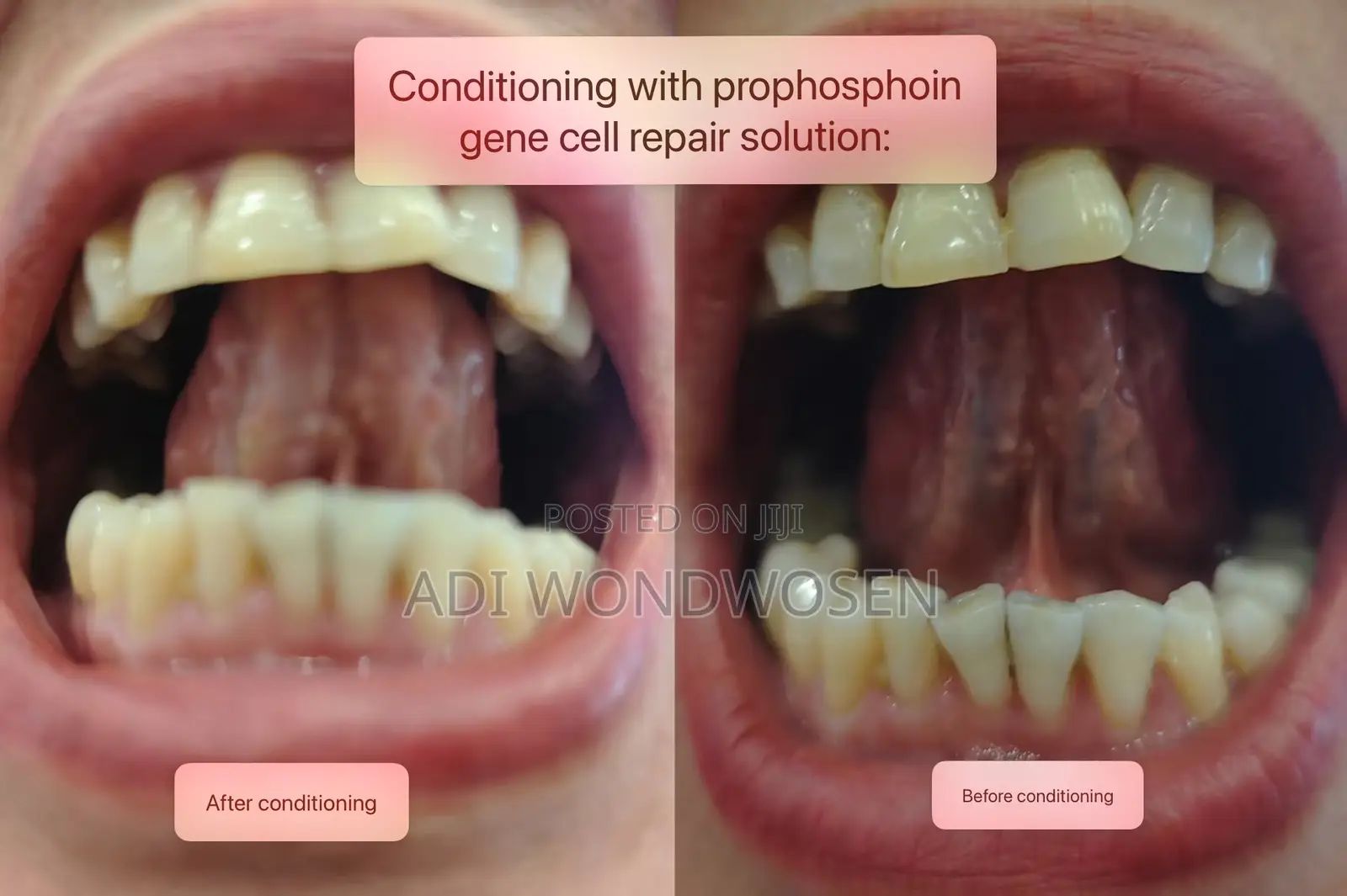 Gene Repair Liquid Spray