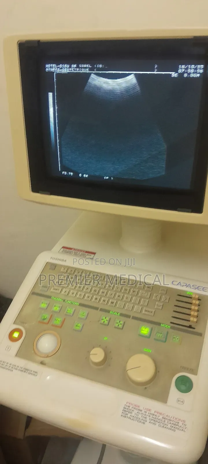 Trolley Ultrasound With Two Probes