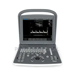 Chiso Eco 2 Ultrasound Machine
