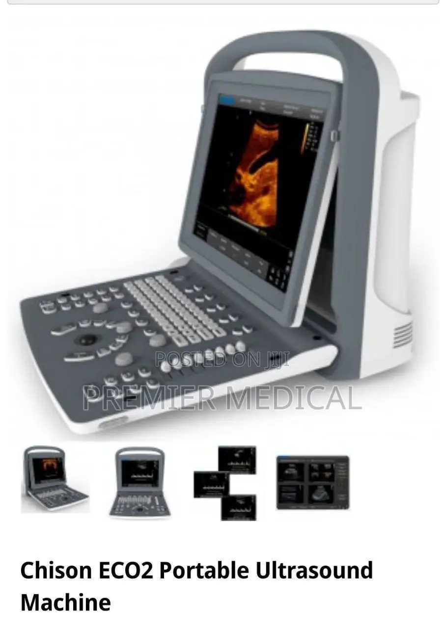 Chiso Eco 2 Ultrasound Machine