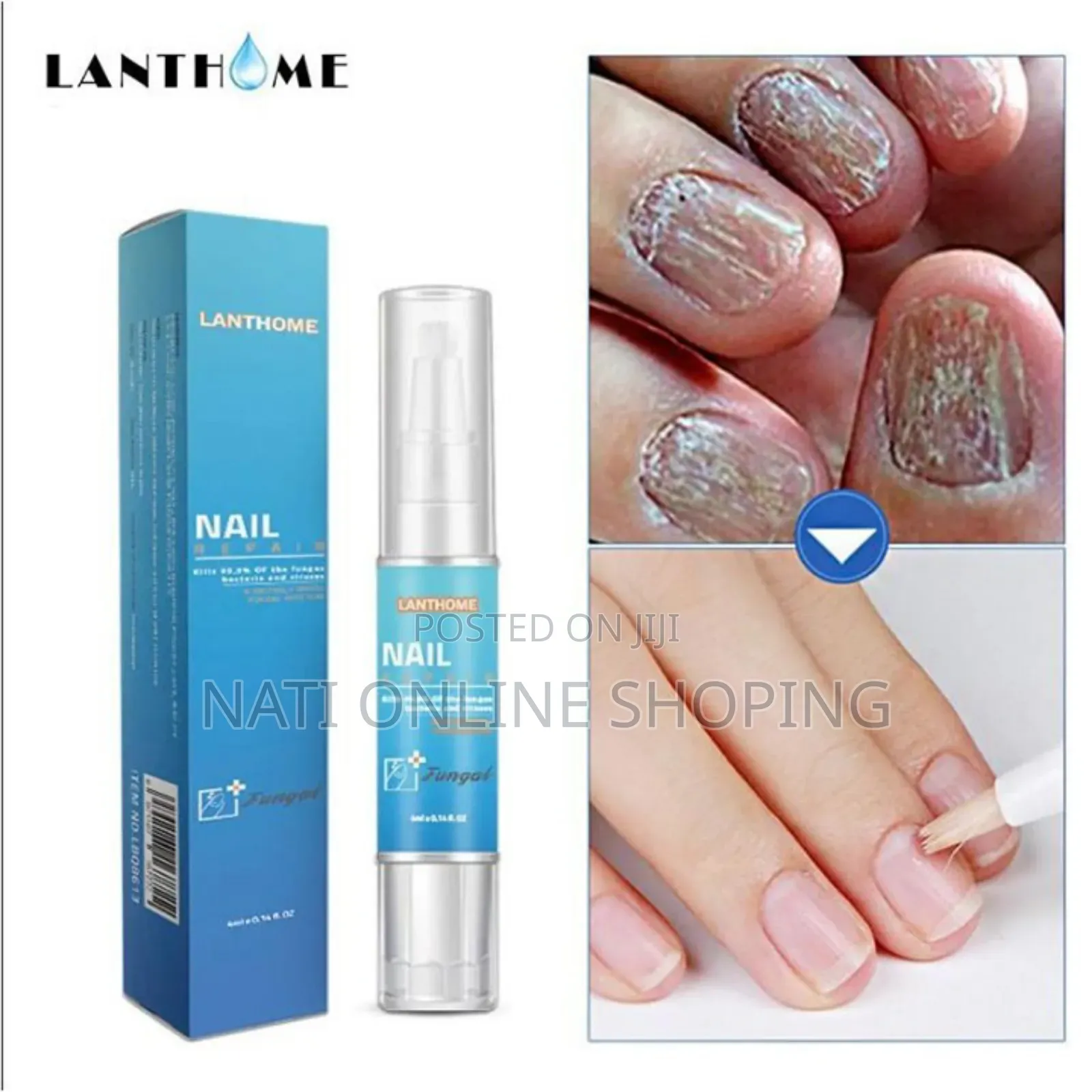 የተበላሸ ጥፍርን ወደ ተፈጥሮ ቦታው የሚመልስ Lanthome Nail Repair