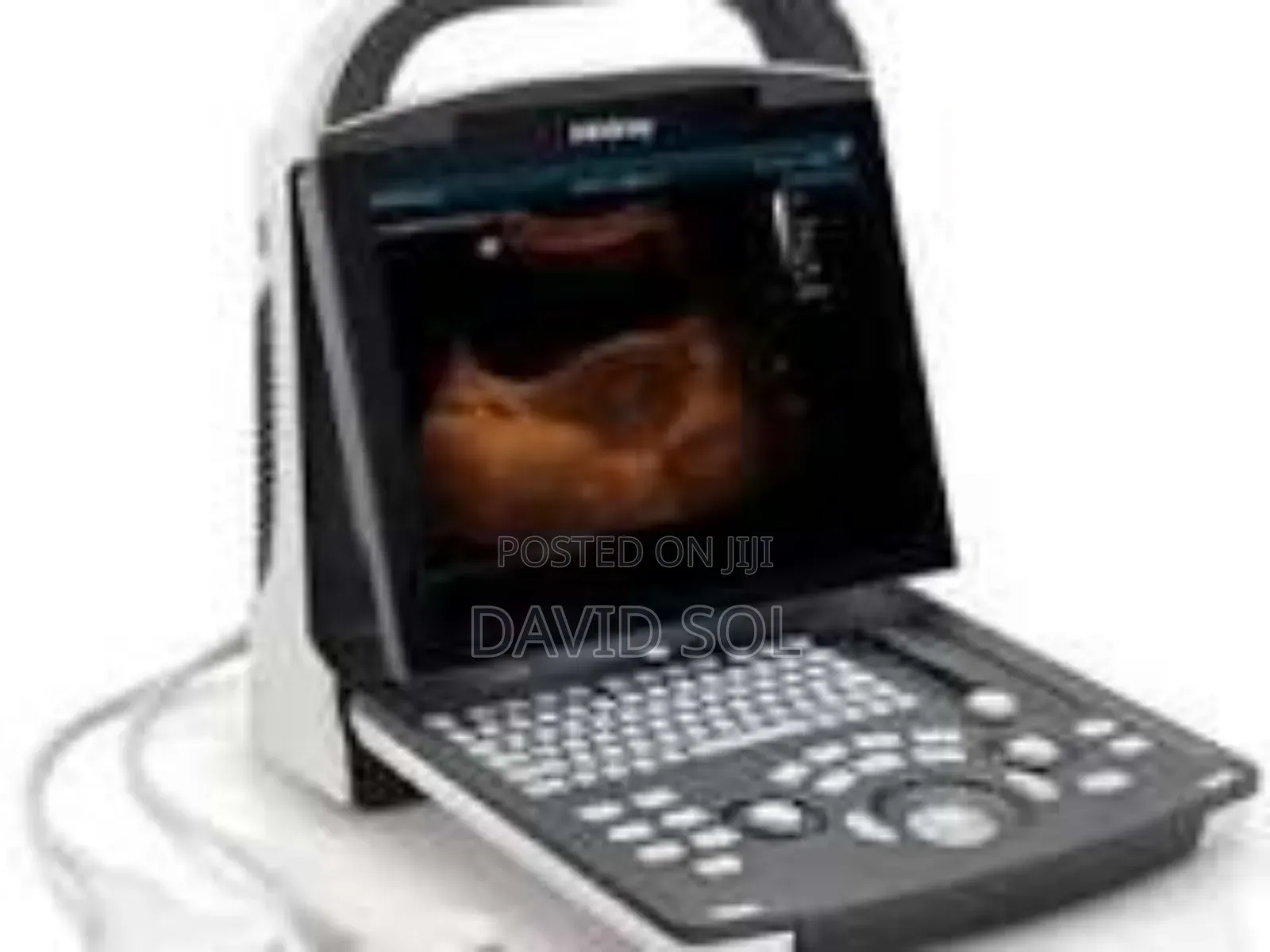 Mindray Dp-15 Portable Ultrasound System 1 Probe