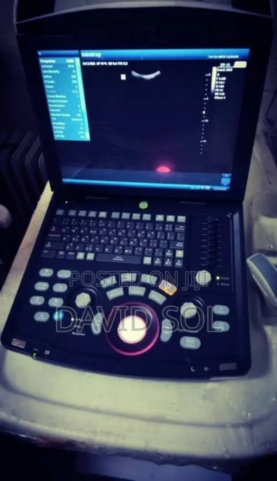 Mindray Dp-15 Portable Ultrasound System 1 Probe