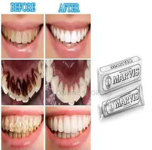 Marvis የጥርስ ማፅጃ