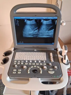 Color Doppler Ultrasound Machine With Two Probes