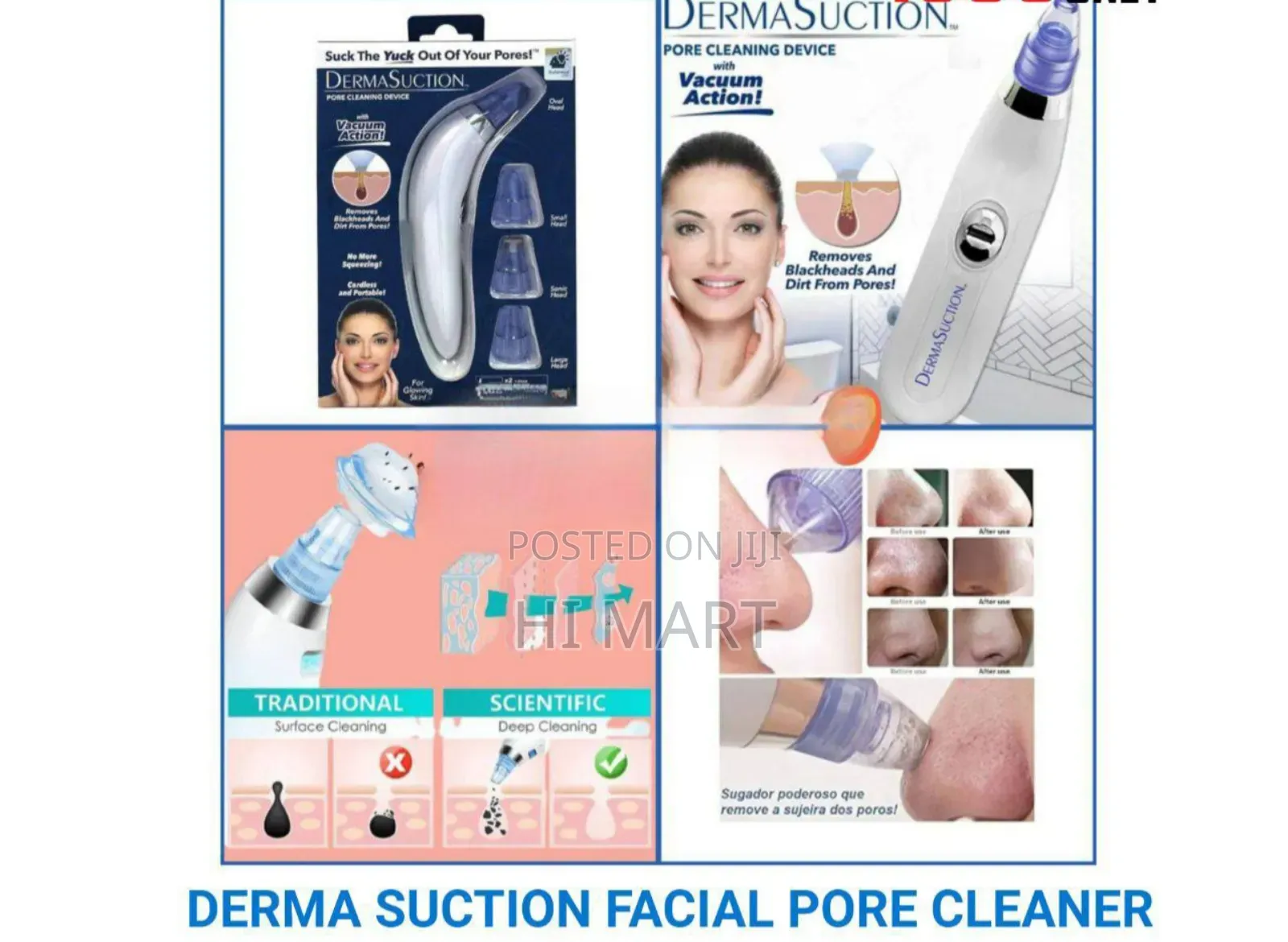 Derma Suction Facial Pore Cleaner