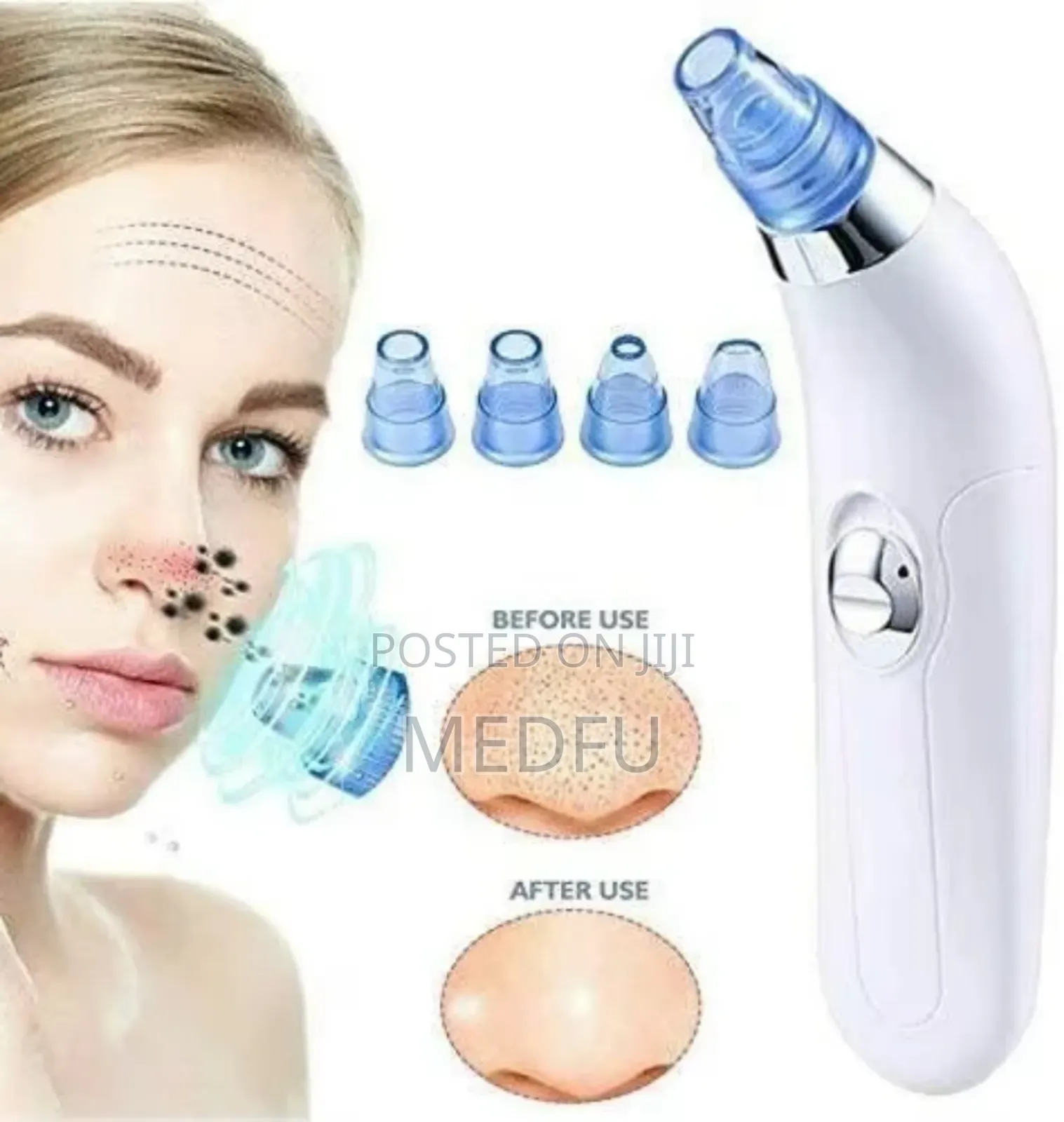 Facial Vacuum Blackhead Acne Pore Skin Cleaner