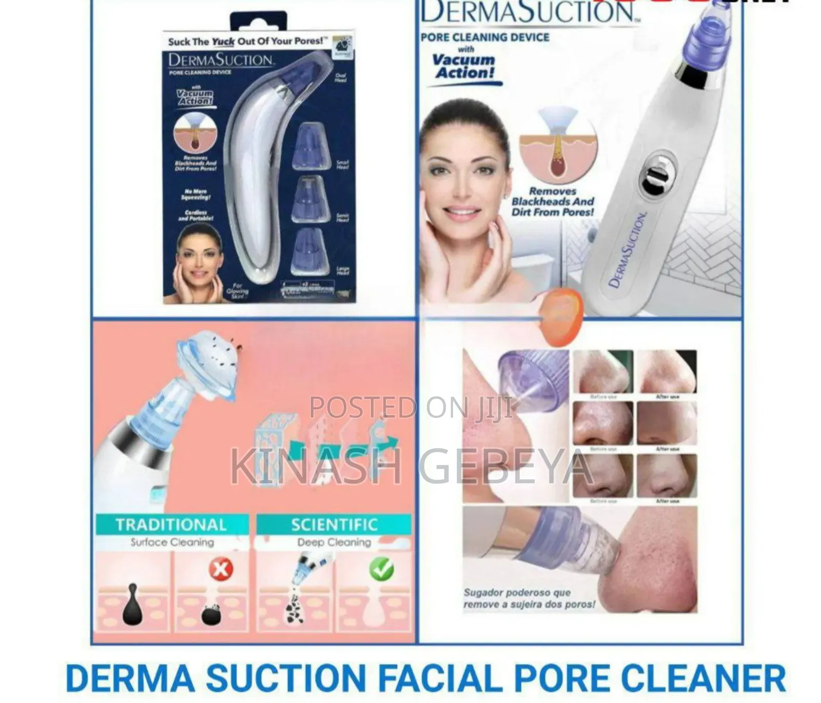 Top Quality Derma Suction Facial Pore Cleaner