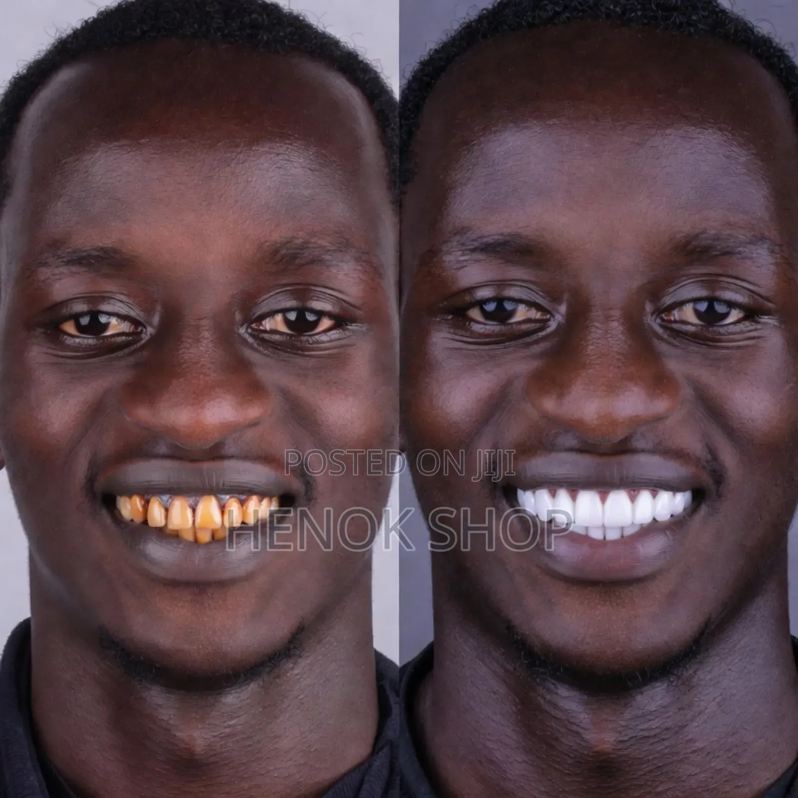 የጥርስ ማንጫ Marvis Whitening Toothpaste