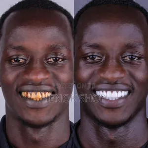 የጥርስ ማንጫ Marvis Whitening Toothpaste