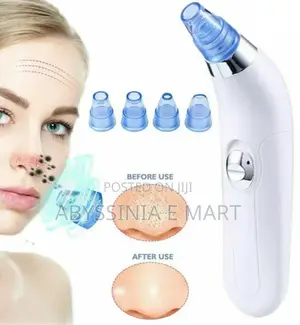 Dermasuction Facial Pore Cleaner ለቆዳችን ጤንነት ተስማሚ ተደርጎ የተሰራ!