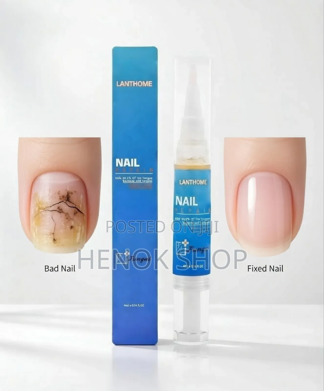የተጎዳ ጥፍርዎን በጥቂት ሳምንት ያስተካክሉ! Lanthome Nail Repair