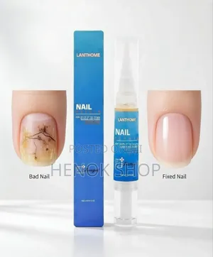 የተጎዳ ጥፍርዎን በጥቂት ሳምንት ያስተካክሉ! Lanthome Nail Repair