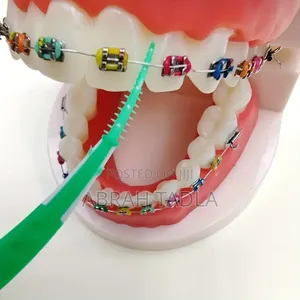Toothpick FLR Braces()