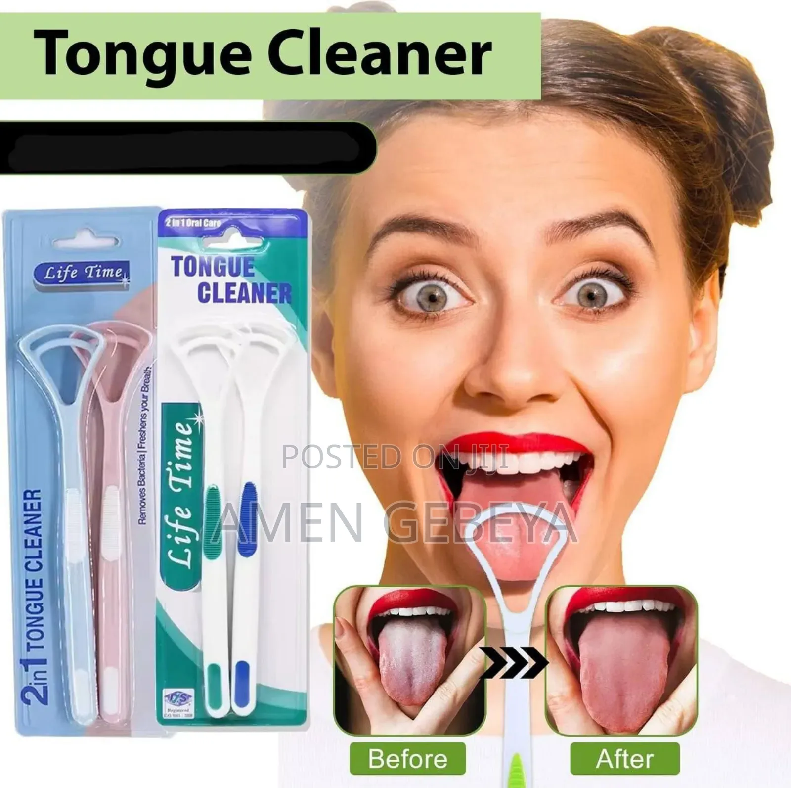 Tongue Cleaner