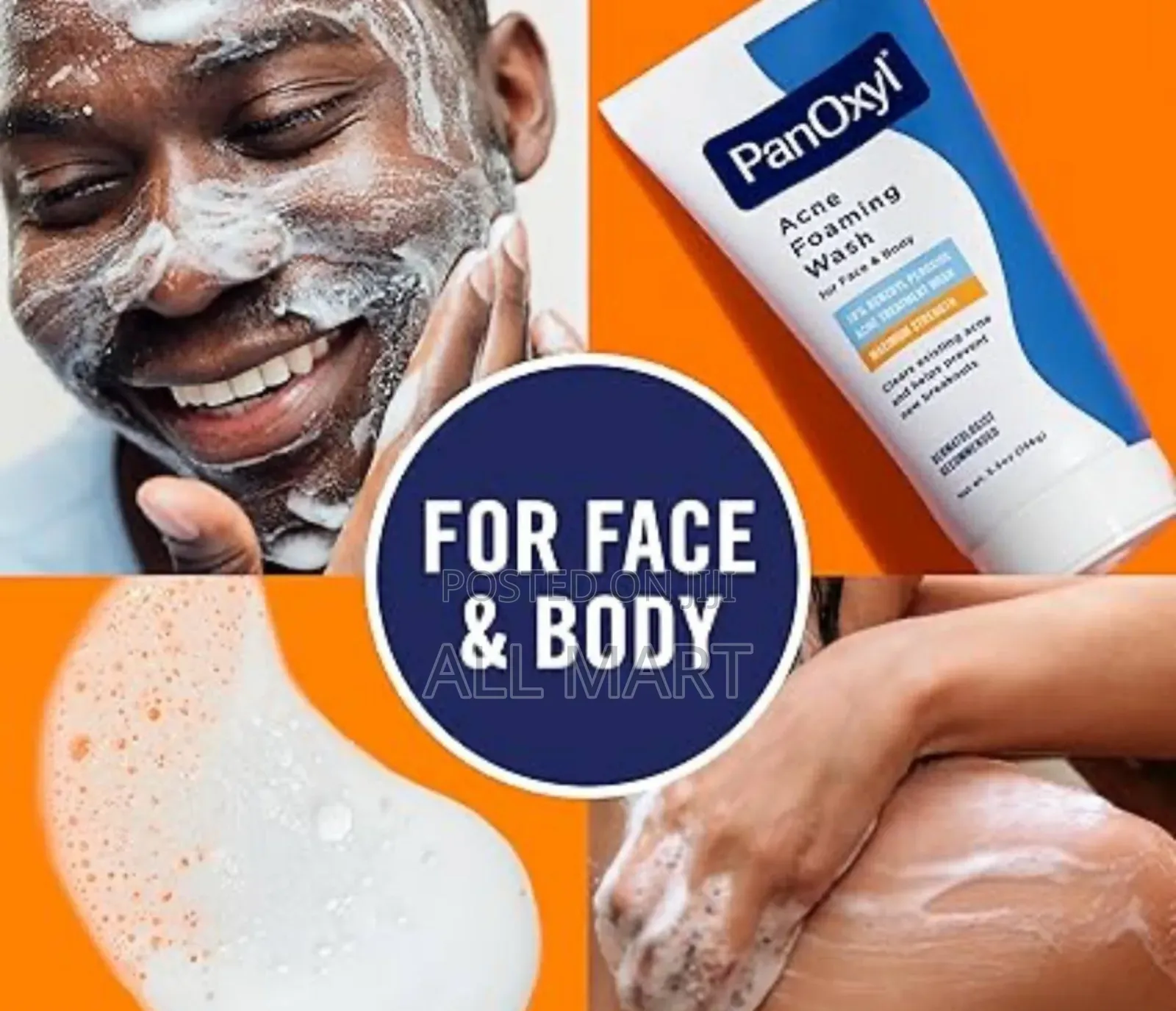 Panoxyl Acne Creamy Wash (4% 10% Benzoyl Peroxide)