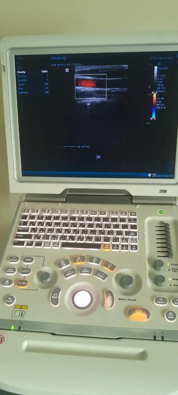 Mindray Z6 Celer Doppler Ultrasound Machine