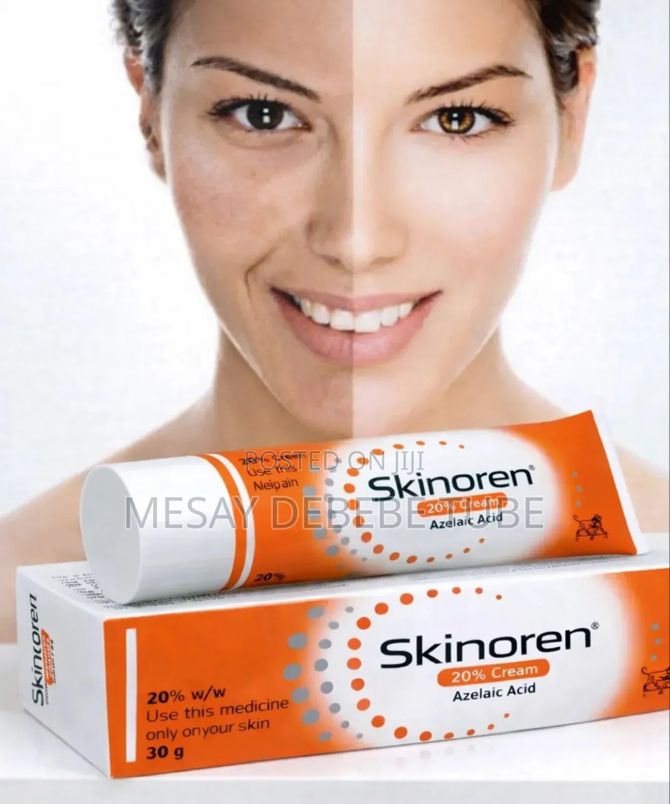 Skinoren Face Care