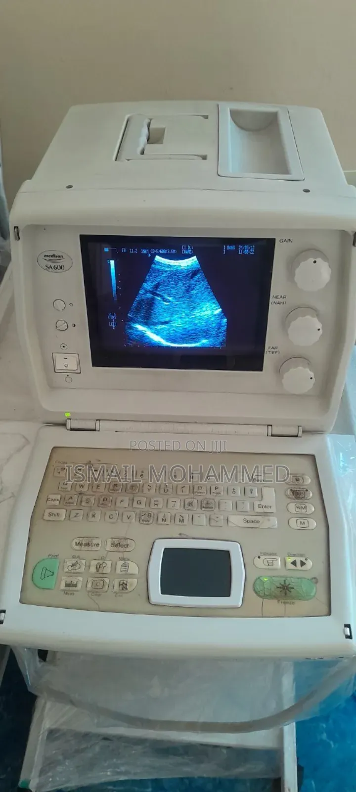 Medison Sa600 Ultrasound Machine