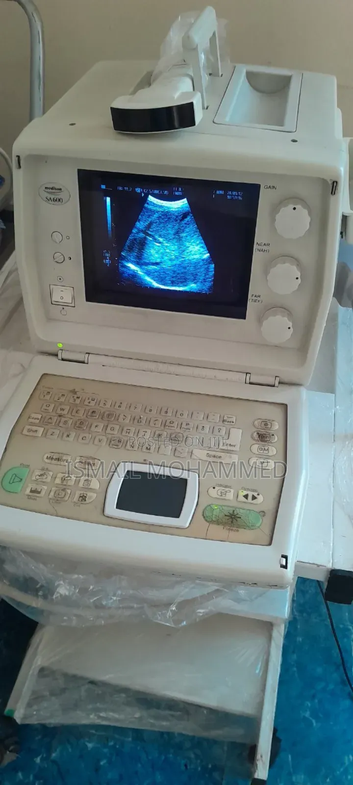 Medison Sa600 Ultrasound Machine