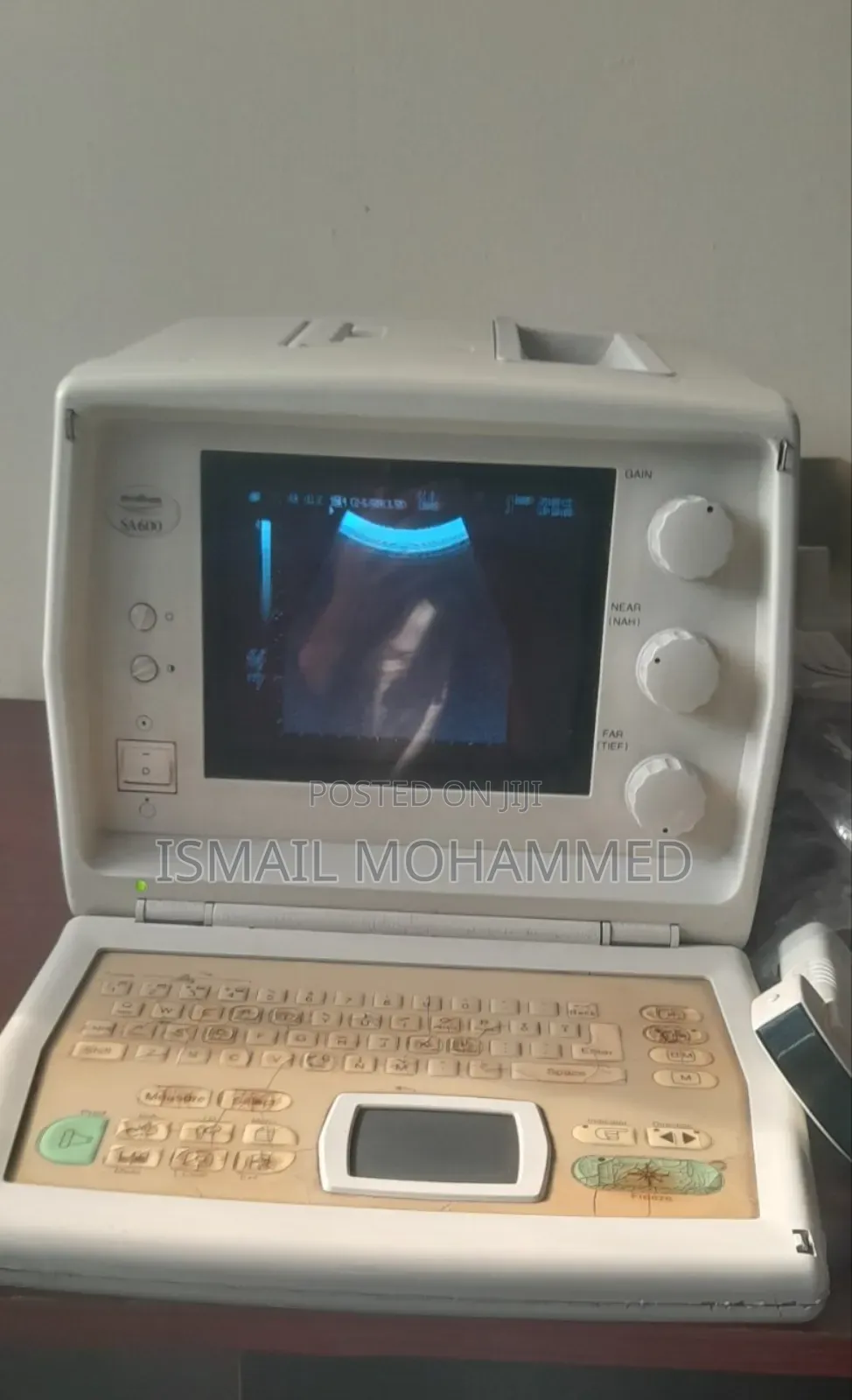 Medison Sa600 Ultrasound Machine