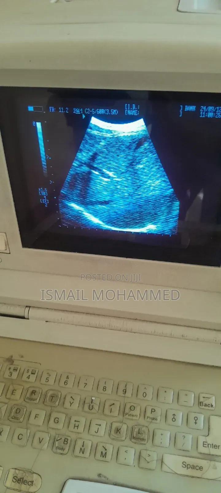 Medison Sa600 Ultrasound Machine