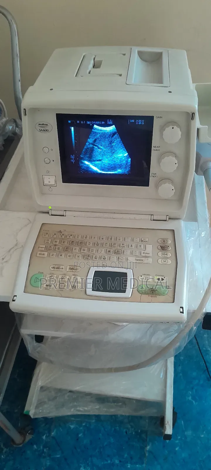 Medison Sa600 Ultrasound