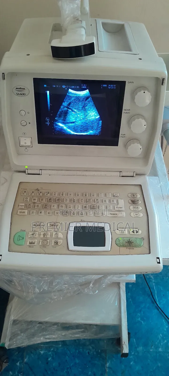 Medison Sa600 Ultrasound