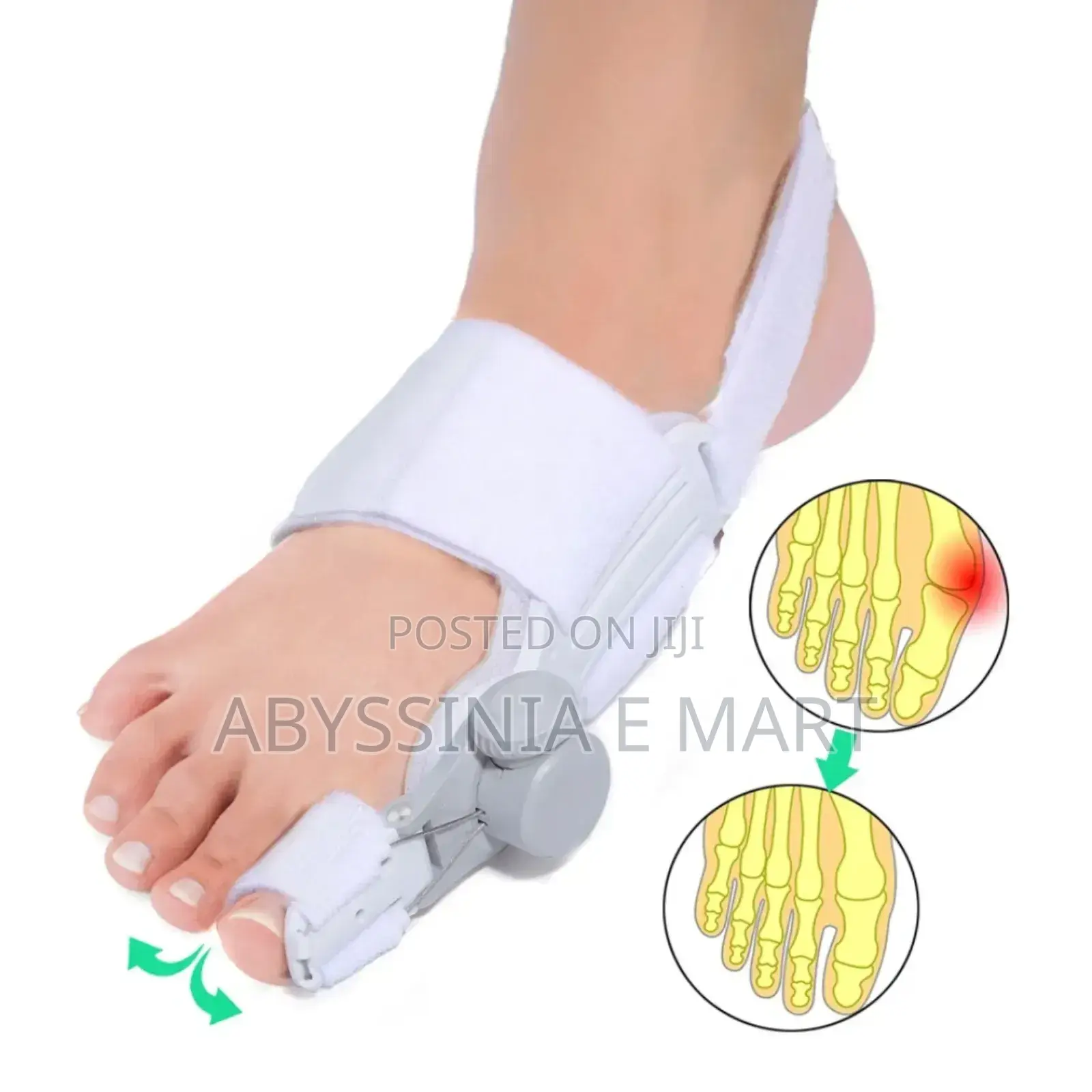 Comfortable And Easy Bunion Aid Splint
