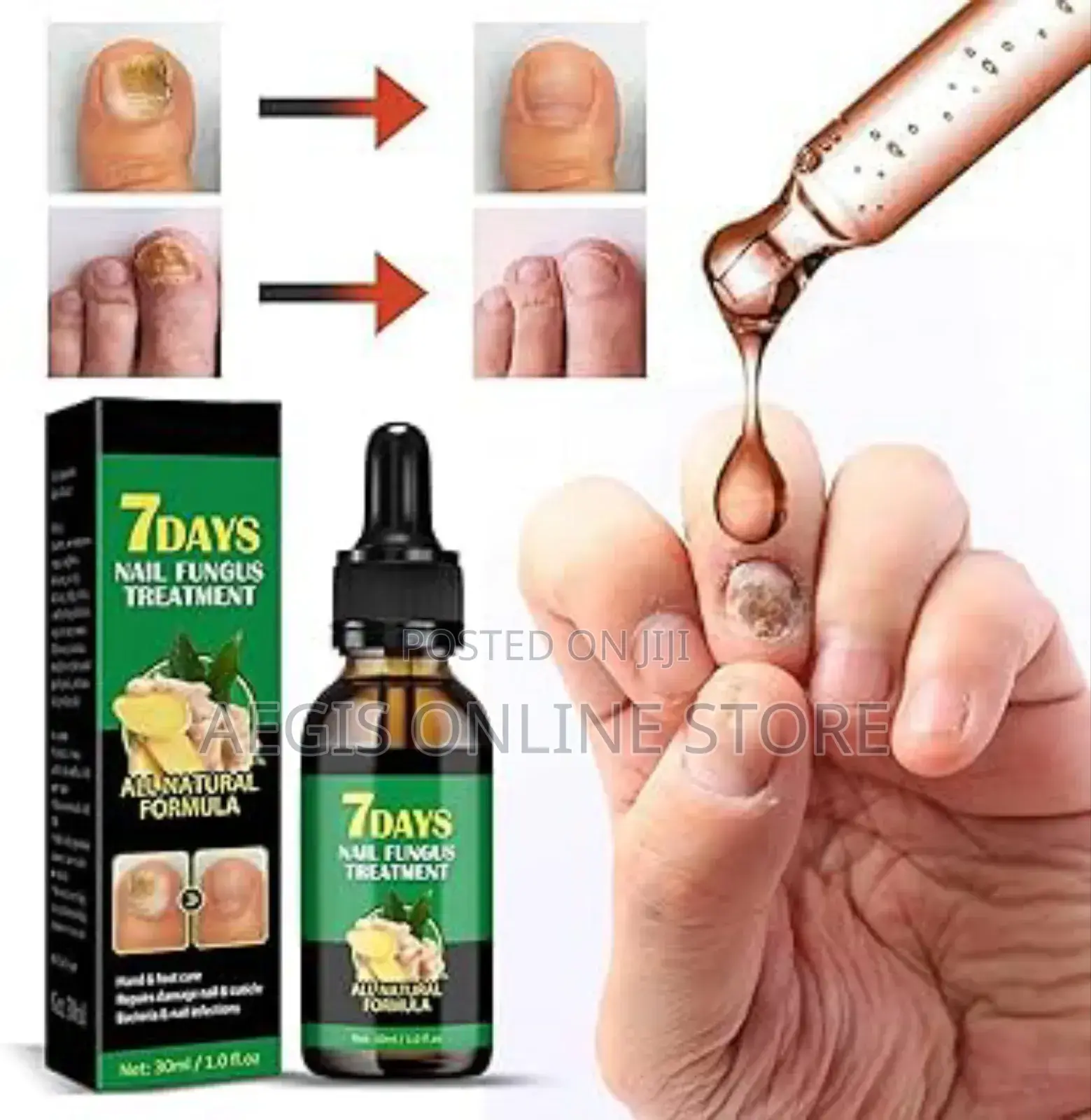 7days Nail Fungus Treatment