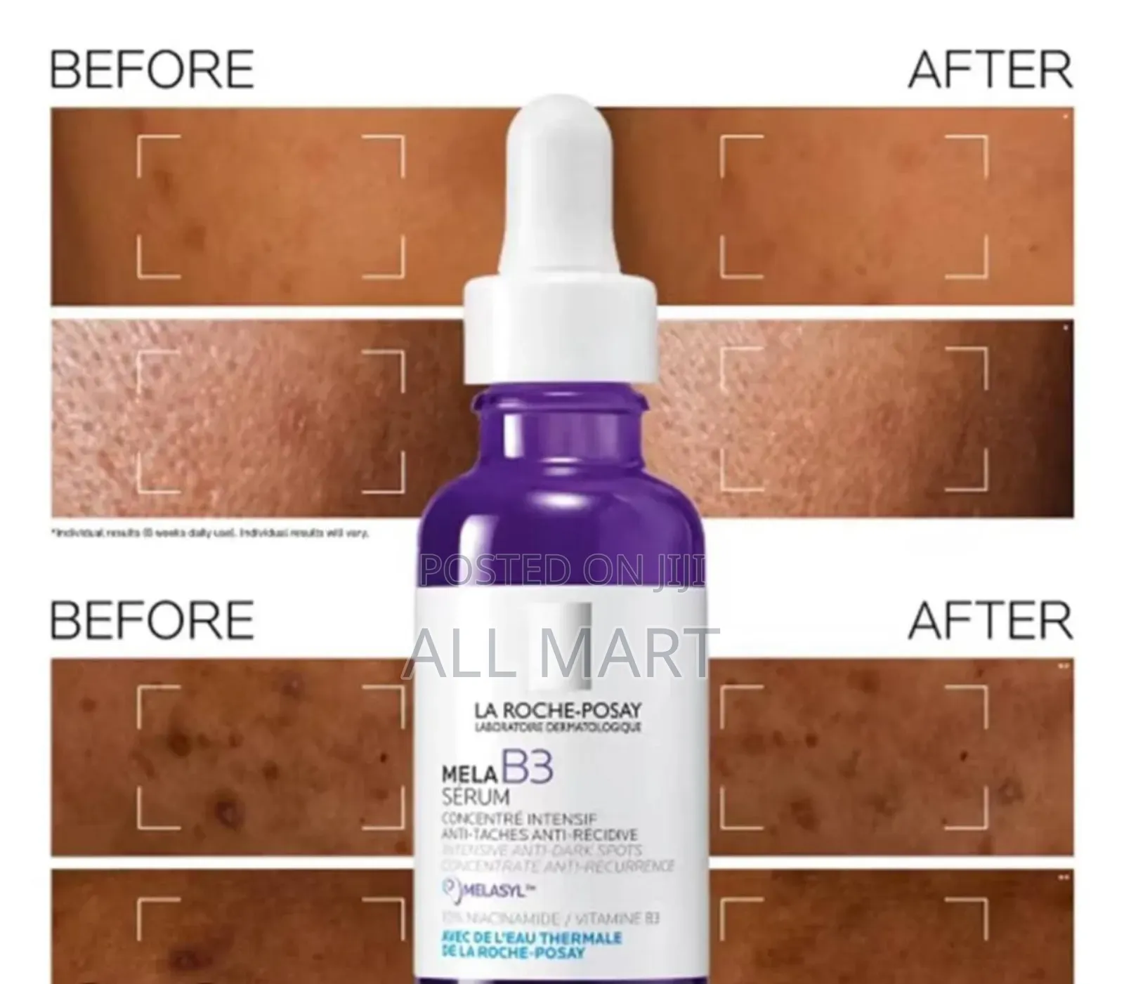 La Roche-Posay Mela B3 Serum