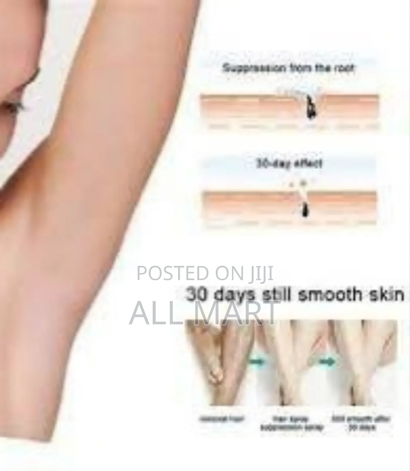 Painless Hair Removal Exfoliation