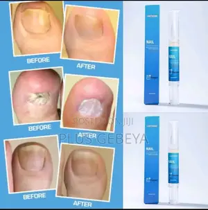 Lanthome Nail Repair Pen - የጥፍር ፈንገስን በፍጥነት የሚያጠፋ