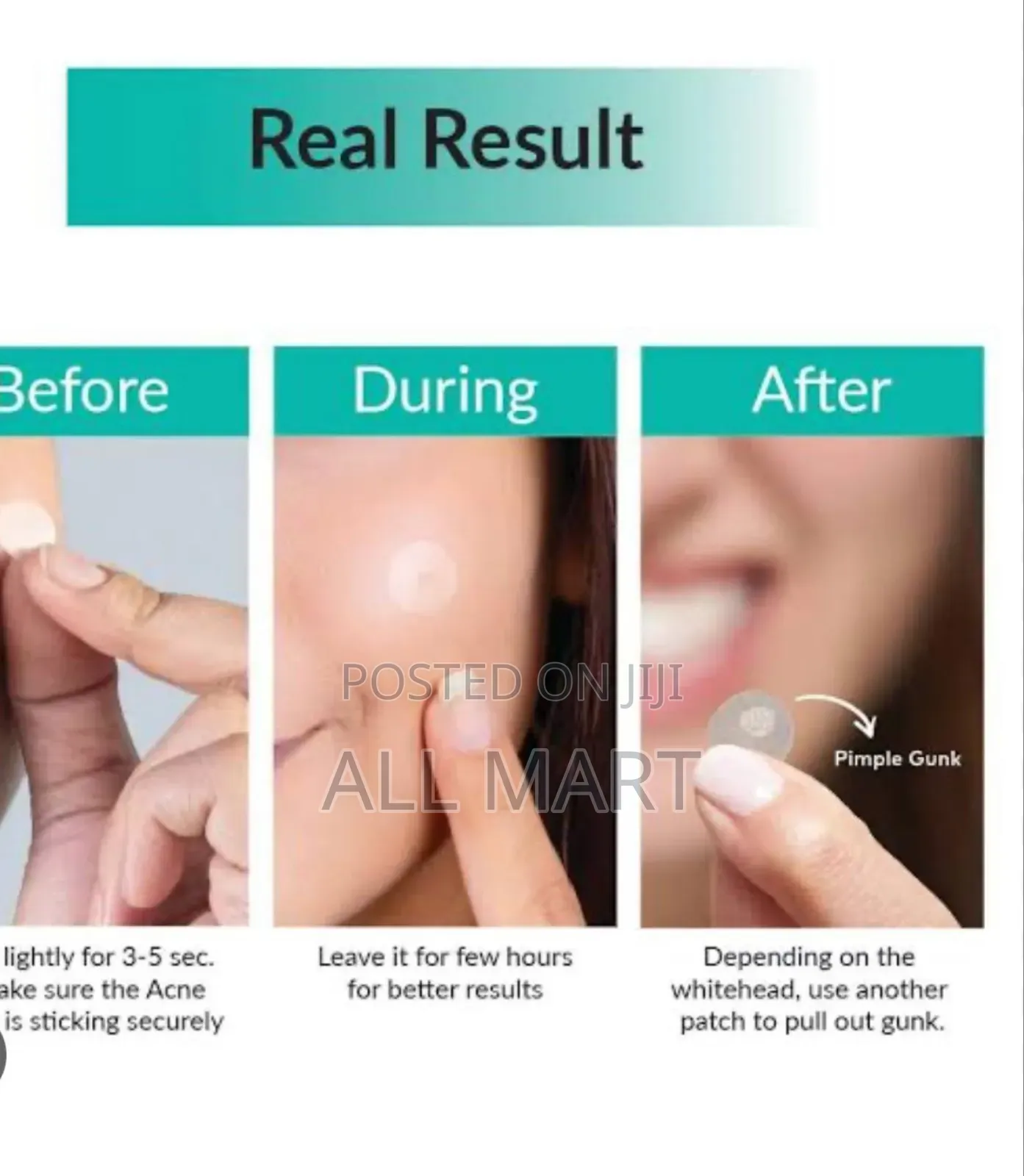 Some Bymi Clear Spot Patch