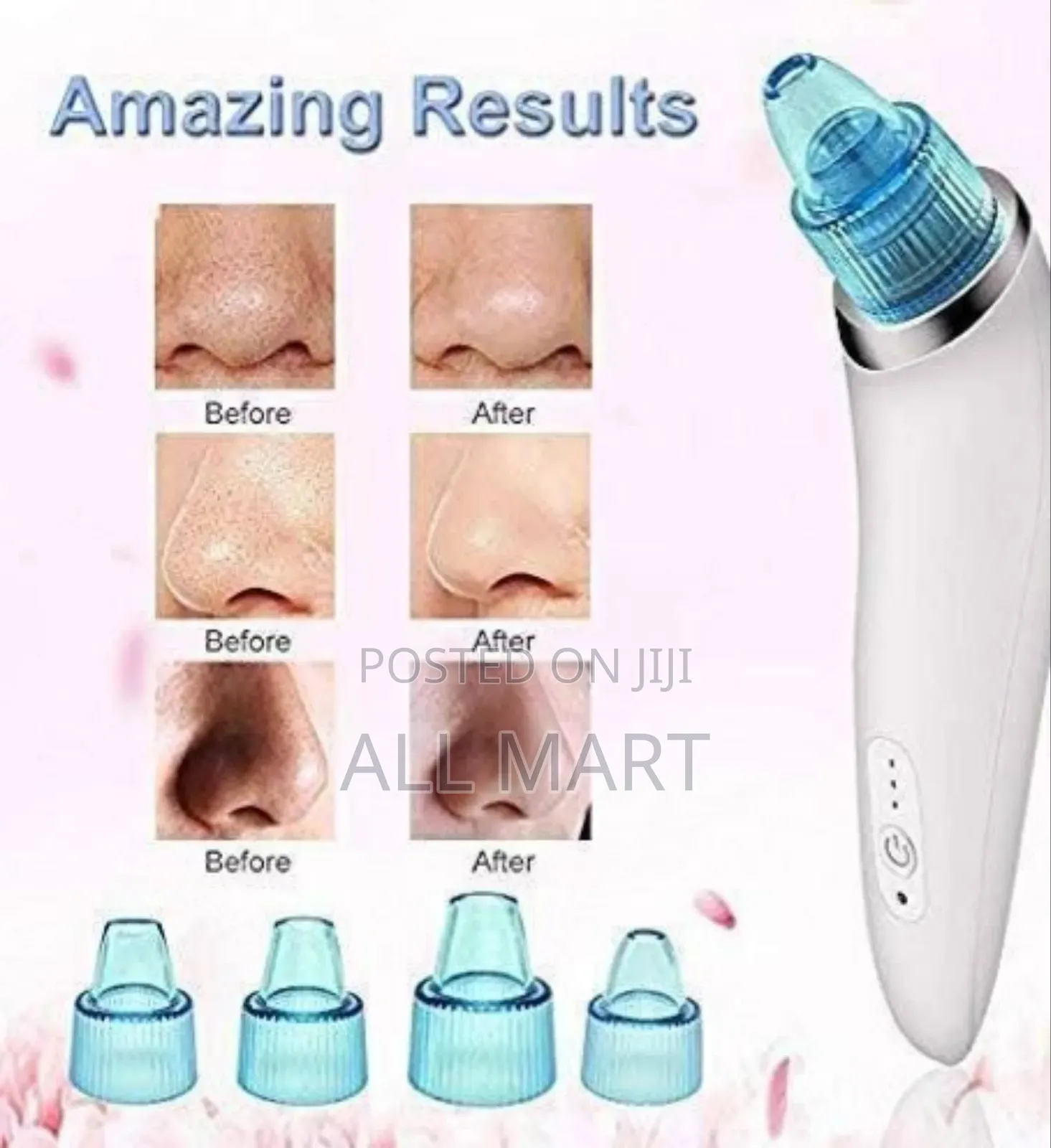 Vacuum Blackhade Remover