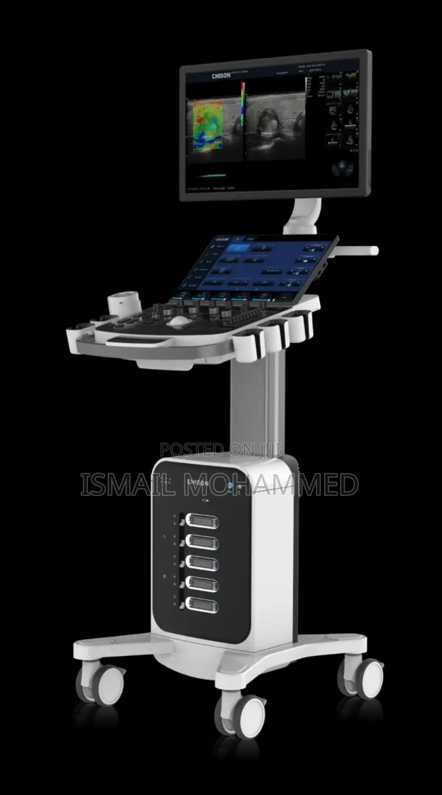 Chison Xbit 60 Digital Ultrasound