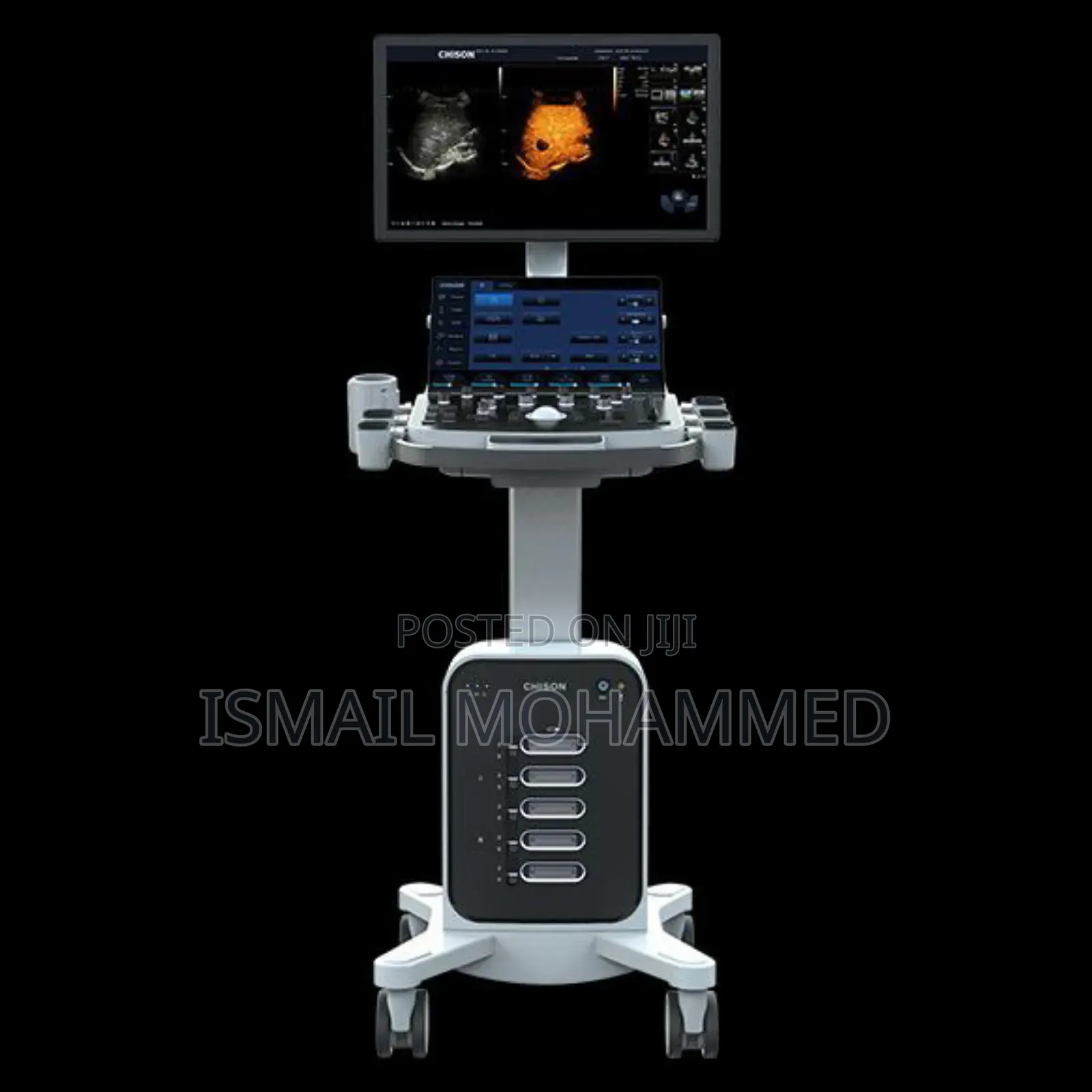 Chison Xbit 60 Digital Ultrasound