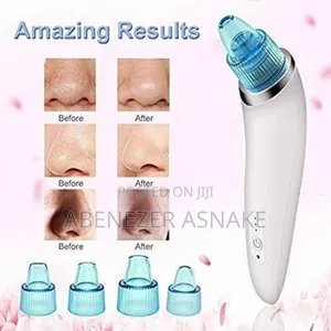 Vacuum Blackhead Remover