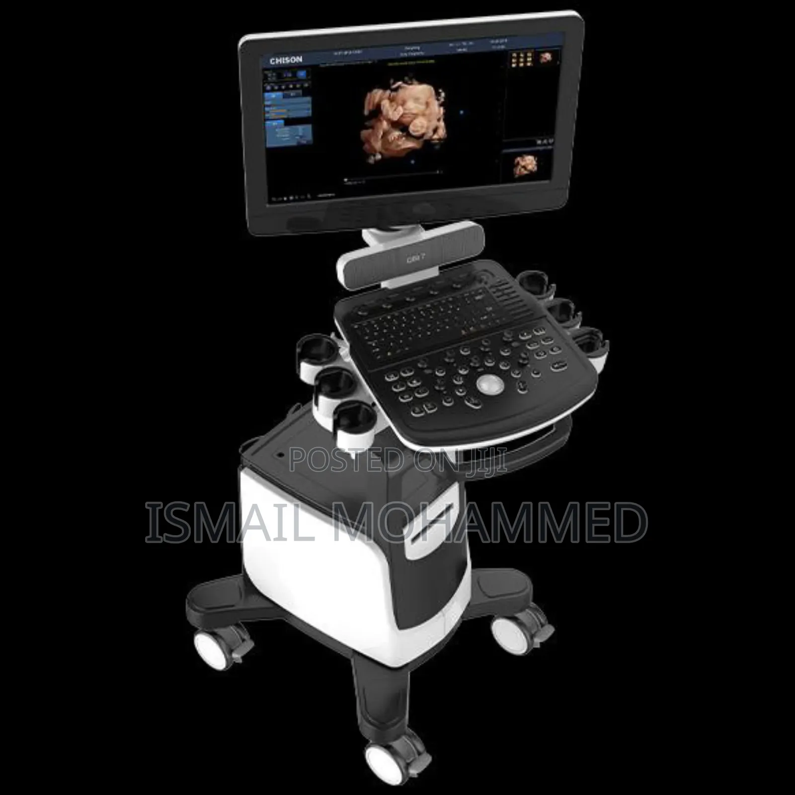 New Color Doppler Ultrasound Machine