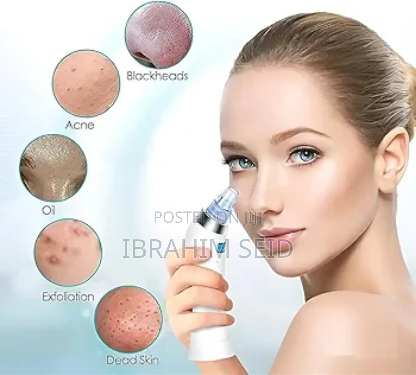 Multifunctional Blackhead Remover
