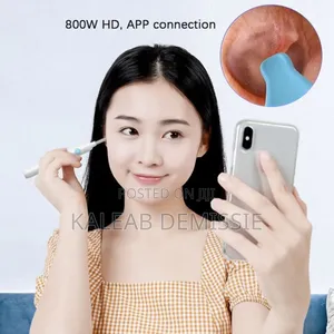 የጆሮ ማጽጃ Wireless Visible Ear Pick