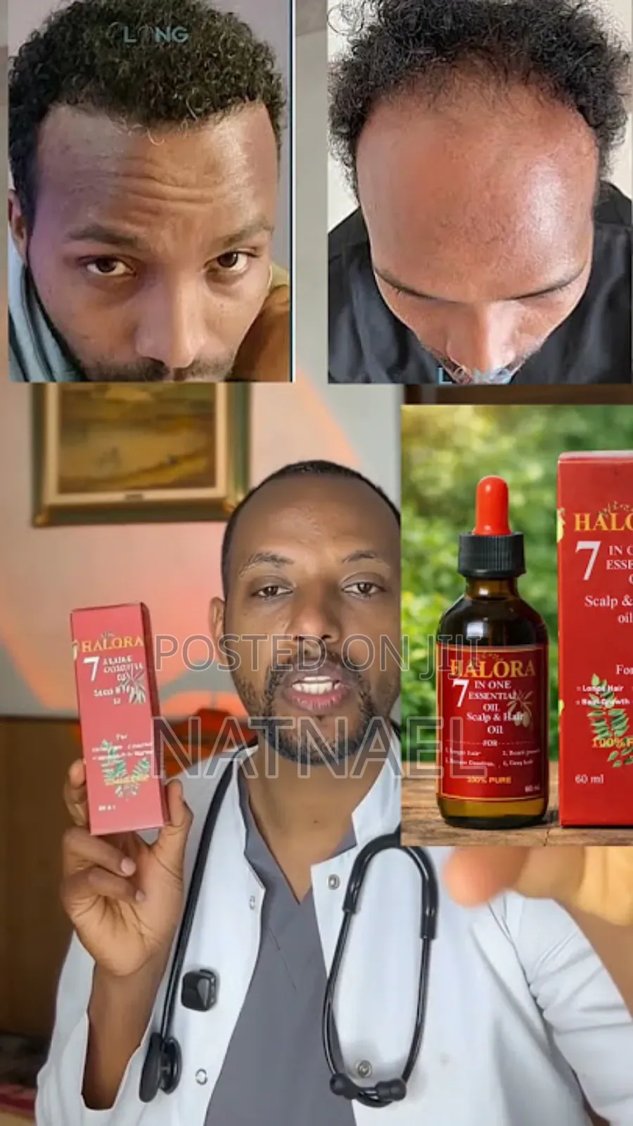 Halora 7 in One Essential Scalp Hair Oil