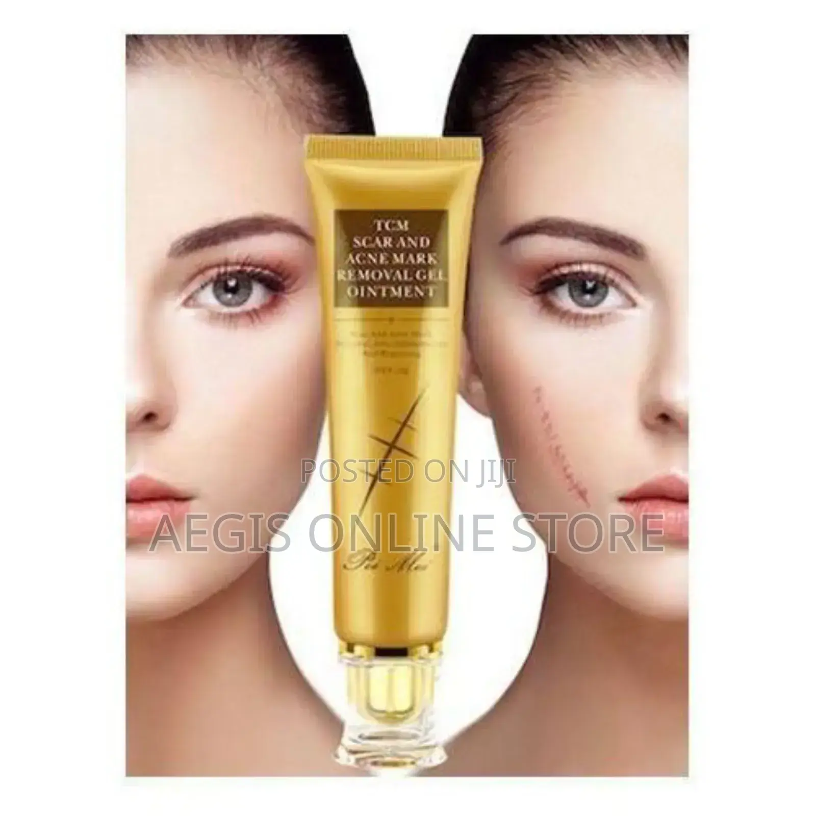 Pei Mei Scar and Acne Mark Removal Gel Ointment