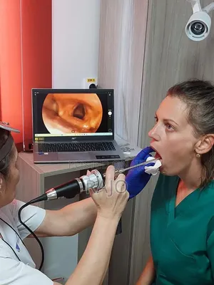 Rigid Otoscope